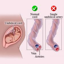 SUA In Pregnancy In Pune